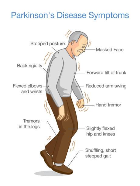 Parkinsons symptoms