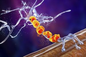 Graphic showing an MND attack.